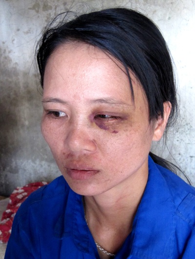 Lời kêu cứu của người phụ nữ sau 14 năm bị chồng bạo hành - 1