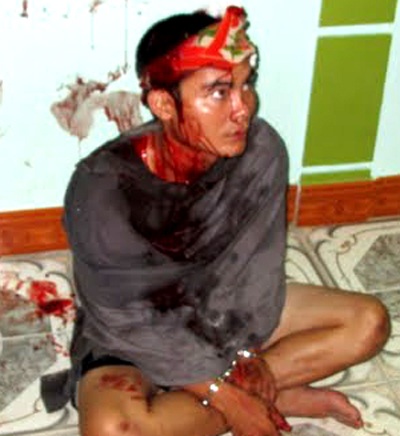 Đề nghị khởi tố “cẩu tặc” bắt cháu bé 5 tuổi làm con tin - 2