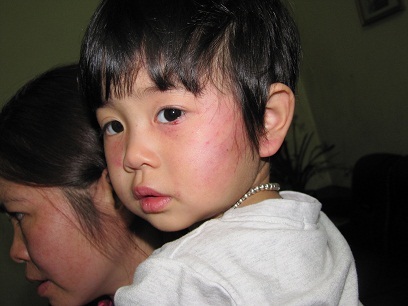 Đình chỉ công tác cô giáo dùng thước đánh vào mặt cháu bé 2 tuổi