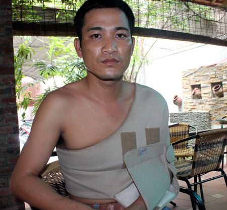 Bị đánh vỡ lách, tràn khí màng phổi, cướp tiền khi đi buôn trâu