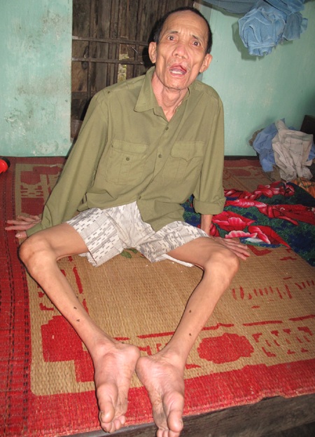 Các con của ông Hóa chỉ biết ngồi cười trong vô thức.