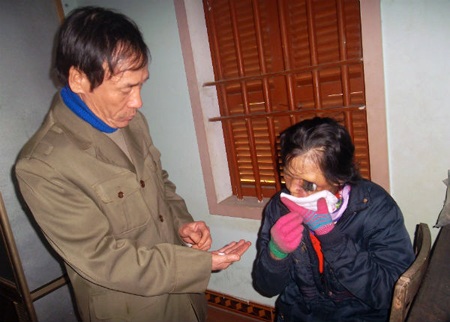 Xót thương người đàn bà "một mắt" - 2 Khuôn mặt bà Thanh biến dạng sau 2 lần mổ. Hàng ngày bà vẫn phải chống chọi những cơn đau hành hạ.