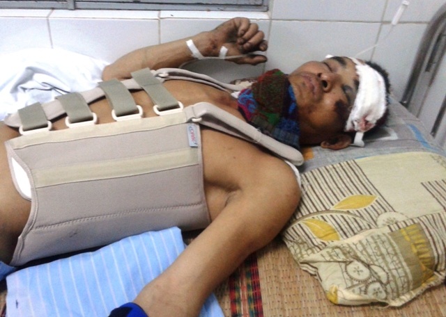 Ông Bùi Khắc Cửu (39 tuổi) bị chấn thương nặng sau vụ sập giàn giáo.