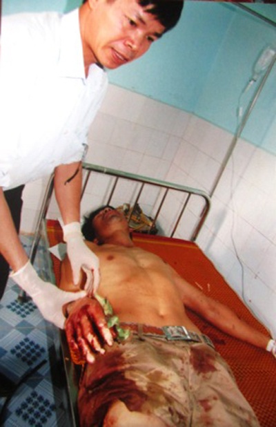 Anh Lương ngày bị chém đến gần 20 nhát. 