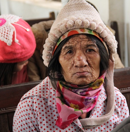 ... hay như cụ bà này bị nổi u đầy mặt có mặt tại buổi trao quà đã làm xúc động mọi người.