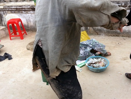 Đột nhiên gã ăn xin này đứng phắt lên đòi ăn thua với người chụp ảnhtrong bộ dạng te tua...