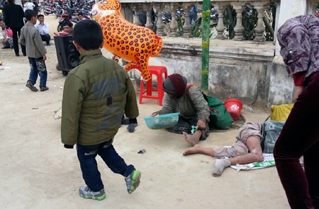 Đột nhiên gã ăn xin này đứng phắt lên đòi ăn thua với người chụp ảnhtrong bộ dạng te tua...