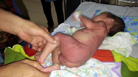 Bác sỹ Hương - Trưởng khoa sơ sinh - BV Sản Nhi Nghệ An đang chăm sóc cháu Hưng.