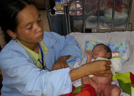 Chị Liên bên đứa con bị u máu.