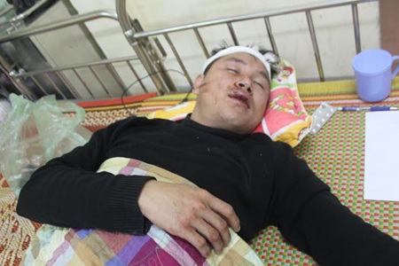 Anh Phúc bị thương ở vùng mặt, đầu sau vụ việc.