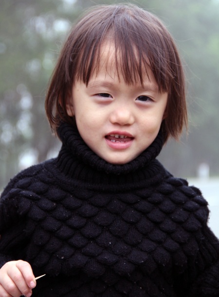 Bé Mận gần 4 năm sau.