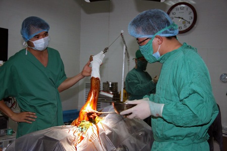 Ca mổ được thực hiện thành công. 