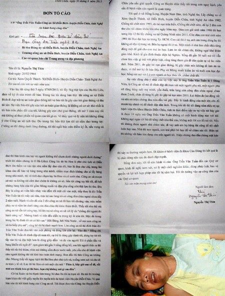 Phó công an xã bị “tố” đánh người nhập viện