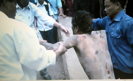 Sau đó được người dân đưa đi cấp cứu.