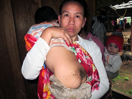 Bà ngoại bé Đức kể từ ngày cháu về luôn phải bế cháu.