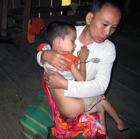 Hằng đêm cháu luôn trắng đêm vì căn bệnh lại tái phát. 