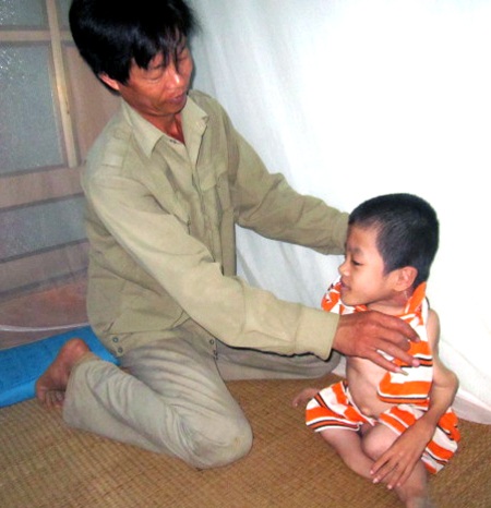 Nghị lực phi thường của cậu học trò xương thủy tinh cao 80cm