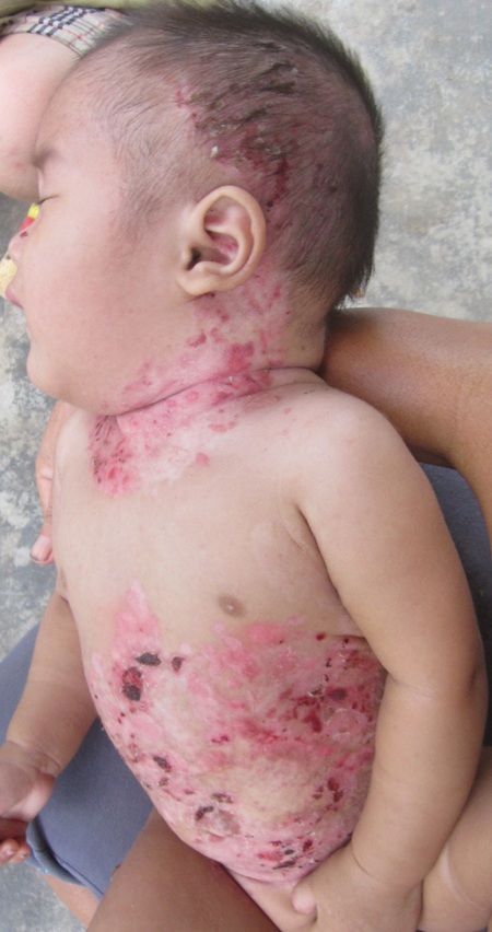 Tiếng khóc cháu Lộc như kêu cứu chúng tôi mà lòng xót xa.