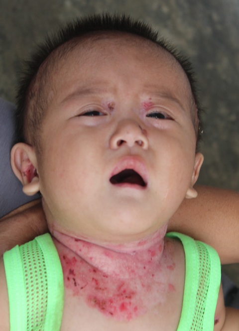 Tiếng khóc cháu Lộc như kêu cứu chúng tôi mà lòng xót xa.