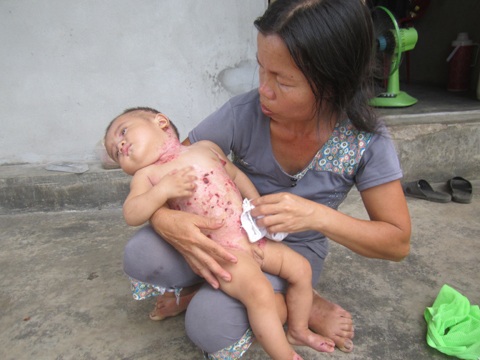 Bà Nguyễn Thị Mai cẩn thận chăm sóc cháu Võ Kim Lộc (6 tháng tuổi).