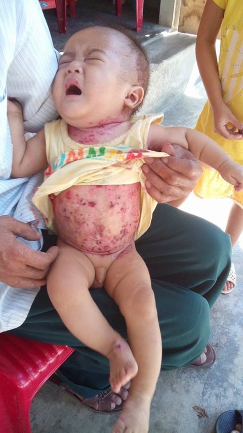 Tiếng khóc cháu Lộc như kêu cứu chúng tôi mà lòng xót xa.