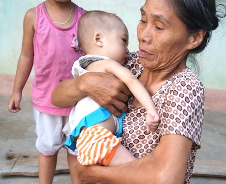 Mắc bệnh tim bẩm sinh, bé 15 tháng tuổi dặt dẹo như sợi bún - 13 Để mong cháu khỏe mạnh, bà ngoại thường bế cháu sang hàng xóm để vừa đi chơi mong cháu khuây khỏa.