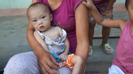 Mắc bệnh tim bẩm sinh, bé 15 tháng tuổi dặt dẹo như sợi bún - 7 Hằng ngày cháu đau đớn khi phải gánh chịu căn bệnh mà gia đình bất lực.