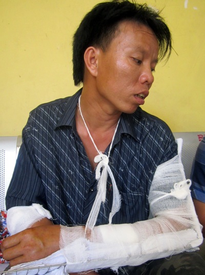 Anh Nguyễn Xuân Hùng bị chém với nhiều vết thương trên tay.