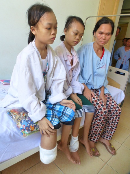 Mấy năm nay hai cháu không tự đi lại được nữa. Hiện giờ chỉ nặng 20kg, da xanh nhợt nhạt.