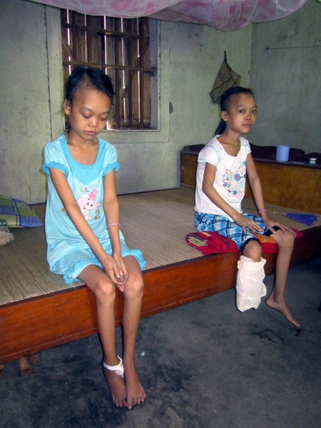 Mẹ khóc lặng nhìn con mỗi ngày rụng mất một phần cơ thể - 6