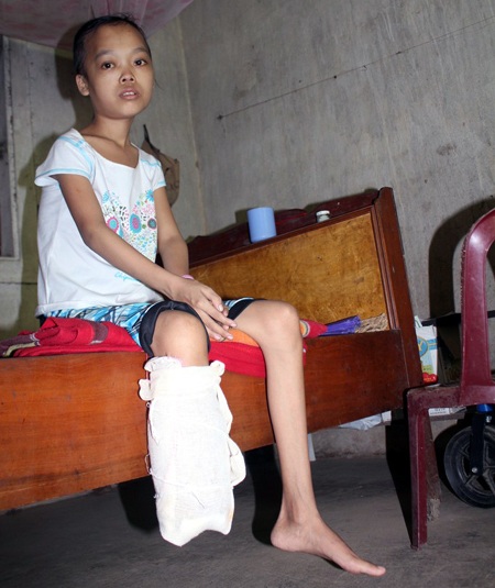 Mẹ khóc lặng nhìn con mỗi ngày rụng mất một phần cơ thể - 3 Chân em một bên đã đứt...