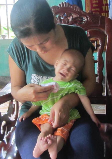 Bé An đau đớn mỗi khi lên cơn.