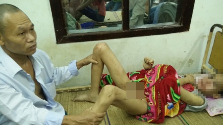 Cháu Tú với vết thương đầy mình đang được điều trị tại BV Đa khoa tỉnh Nghệ An.