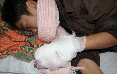 Nghịch pháo, một học sinh nát bàn tay - 1