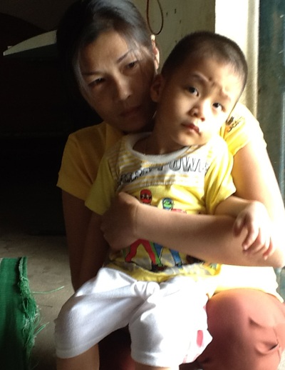 Cô Nhung và cháu Sơn bị một lúc nhiều bệnh như: mù hai mắt, điếc tai, tim bẩm sinh...