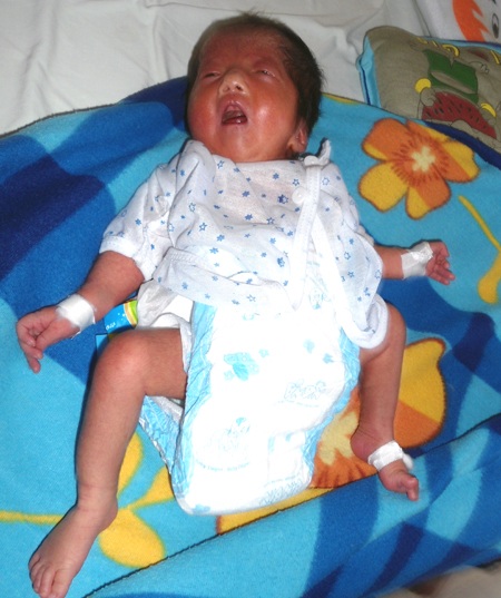 Bé Nhi con anh Hoạt sinh thiếu tháng chỉ được 1,5kg.