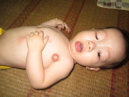 Bị bệnh tim nên cháu Quang rất yếu, hằng ngày chỉ nằm một chỗ quấy khóc.