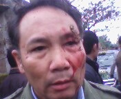 Say mèm tại đám cưới, chặn đánh xe dâu - 1