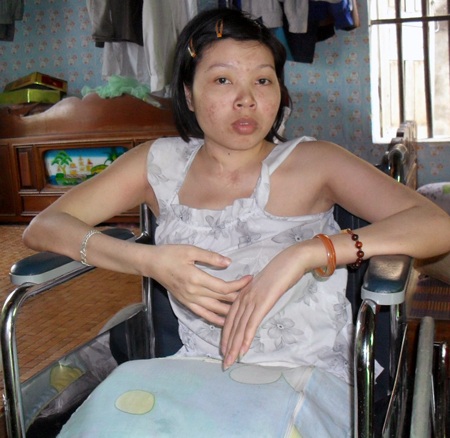 “Đôi chân em giờ như vật… trang trí !”