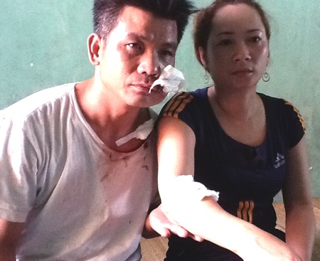 Hai đối tượng truy sát cả gia đình trong đêm sa lưới - 1 Vợ chồng anh Hưng suýt mất mạng sau vụ côn đồ hành hung.