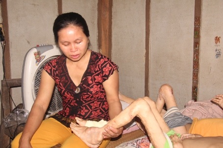 Đôi chân của Sơn và Tài giờ nổi chi chít những cục u như thế này