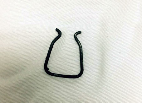 Di vật được lấy ra là một phần của chiếc kẹp sắt dùng để kẹp giấy tờ