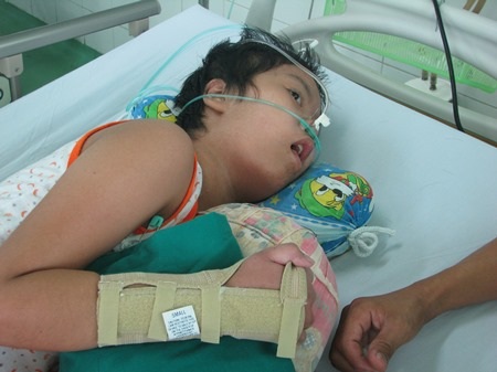 Thời gian nằm viện của cháu Nhi còn dài 