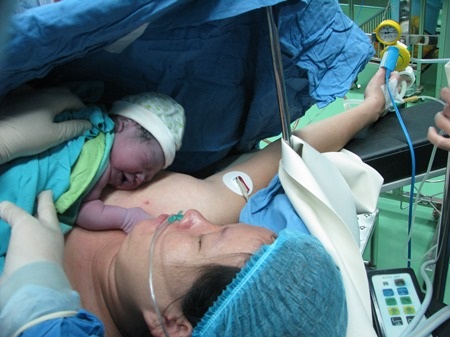 Và đưa đến đặt ngay trên bụng mẹ theo phương pháp da kề da sau sinh