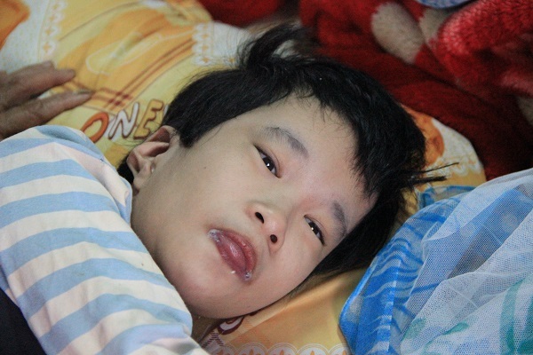 Bé Ngân bị mắc chứng bại não từ khi mới lọt lòng mẹ