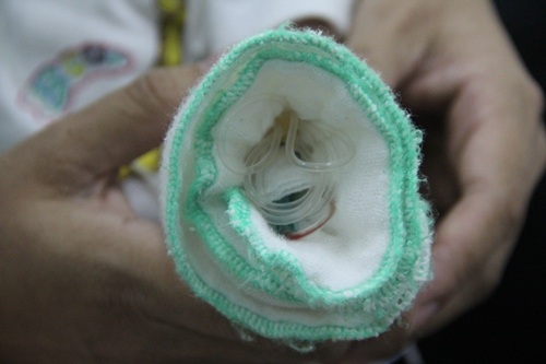 Bé 3 tháng tuổi nguy kịch vì bệnh tim bẩm sinh - 5 Bàn tay bé xíu của bé Minh ngày nào cũng phải chịu nhiều mũi tiêm để vào thuốc rất đau đớn