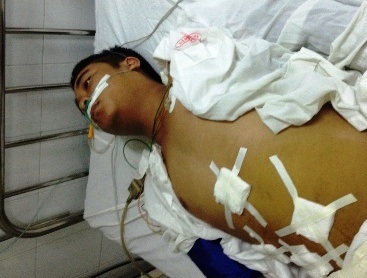 Bệnh nhân Đức sau ca mổ nhầm