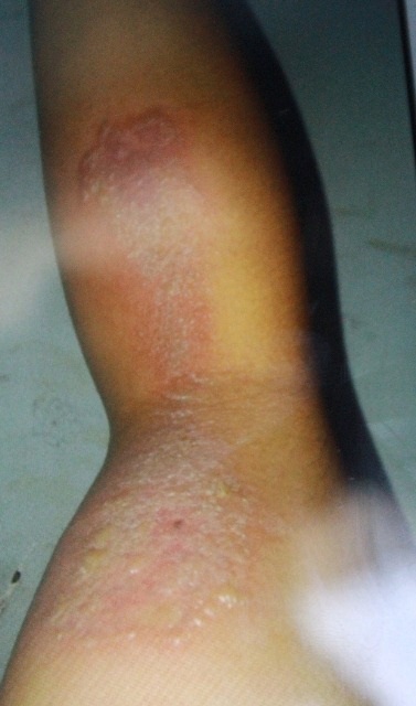 Sinh viên Huế khổ vì kiến ba khoang - 2 Sinh viên Huế khổ vì kiến ba khoang - 2