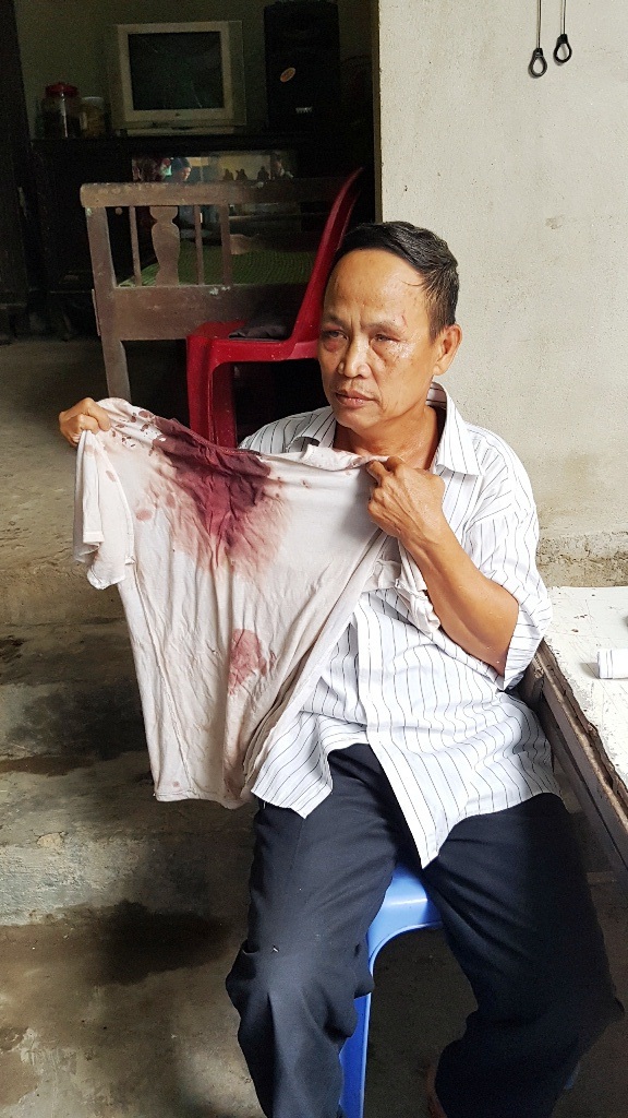 Thừa Thiên Huế: Trưởng hội người mù và con trai bị vào tận nhà đánh trọng thương - 1 Thừa Thiên Huế: Trưởng hội người mù và con trai bị vào tận nhà đánh trọng thương - 1