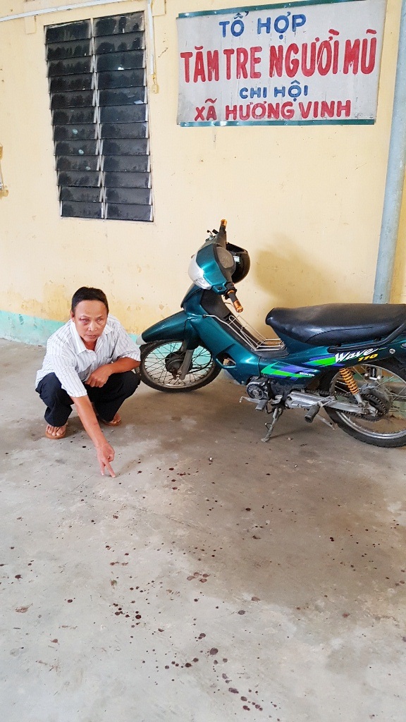 Thừa Thiên Huế: Trưởng hội người mù và con trai bị vào tận nhà đánh trọng thương - 3 Thừa Thiên Huế: Trưởng hội người mù và con trai bị vào tận nhà đánh trọng thương - 3